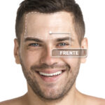 FRENTE HOMBRE