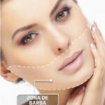ZONA BARBA COMPLETA MUJER