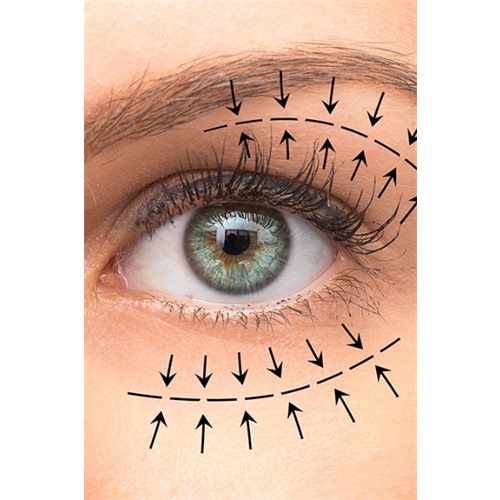 Blefaroplasma: rejuvenecimiento de mirada