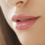 PERFILADO DE LABIOS